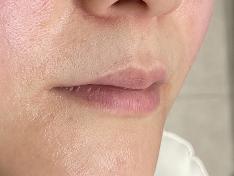 Lip　唇