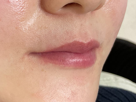 Lip　唇