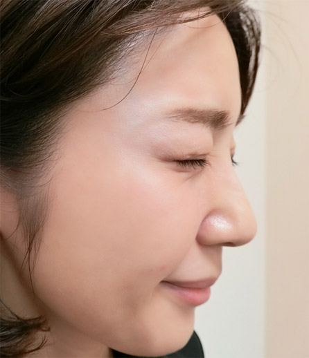 after
