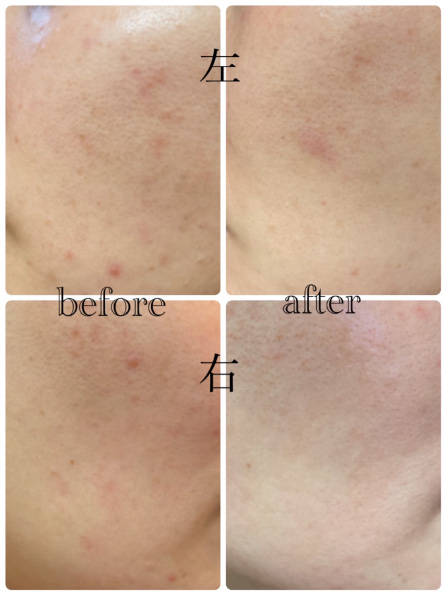 ZO SKIN HEALTH