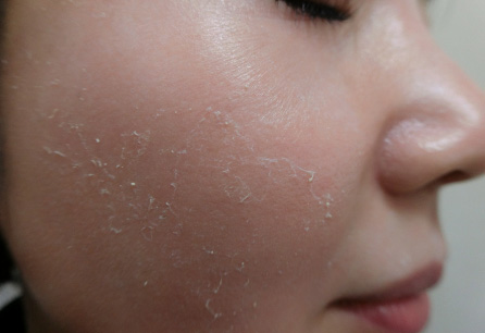 ZO SKIN HEALTH